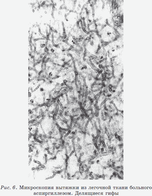 Иллюстрация к книге — Новые тайны нераспознанных диагнозов. Книга 3 [_15.png]