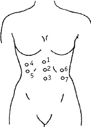 Иллюстрация к книге — Большой атлас целительных точек. Китайская медицина на страже здоровья и долголетия [_235.jpg]