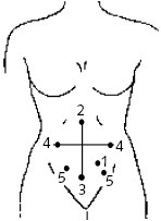 Иллюстрация к книге — Китайский императорский массаж. Лечение 100 болезней с помощью банок. Большой атлас зон исцеления [_12.jpg]