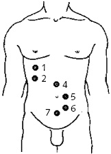 Иллюстрация к книге — Китайский императорский массаж. Лечение 100 болезней с помощью банок. Большой атлас зон исцеления [_26.jpg]