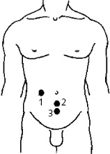 Иллюстрация к книге — Китайский императорский массаж. Лечение 100 болезней с помощью банок. Большой атлас зон исцеления [_36.jpg]