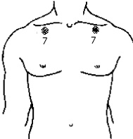 Иллюстрация к книге — Китайский императорский массаж. Лечение 100 болезней с помощью банок. Большой атлас зон исцеления [_40.jpg]