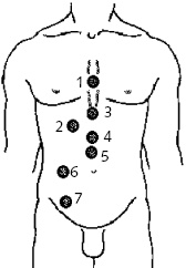 Иллюстрация к книге — Китайский императорский массаж. Лечение 100 болезней с помощью банок. Большой атлас зон исцеления [_42.jpg]
