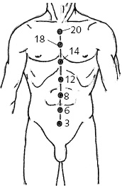 Иллюстрация к книге — Китайский императорский массаж. Лечение 100 болезней с помощью банок. Большой атлас зон исцеления [_64.jpg]