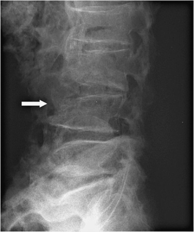 Иллюстрация к книге — Остеопороз. Руководство для практических врачей [i_001.jpg]