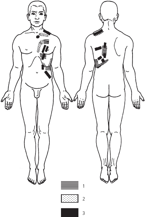 Иллюстрация к книге — Лечебные точки организма. Снимаем боли в сердце и в области живота [_60.jpg]