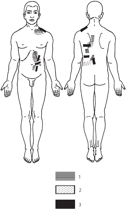 Иллюстрация к книге — Лечебные точки организма. Снимаем боли в сердце и в области живота [_69.jpg]