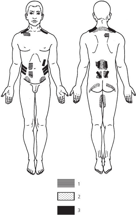 Иллюстрация к книге — Лечебные точки организма. Снимаем боли в сердце и в области живота [_70.jpg]