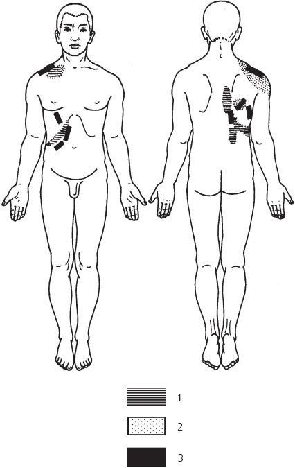 Иллюстрация к книге — Лечебные точки организма. Снимаем боли в сердце и в области живота [_71.jpg]