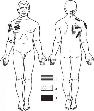 Иллюстрация к книге — Массаж. Уроки великого мастера [_123.jpg]