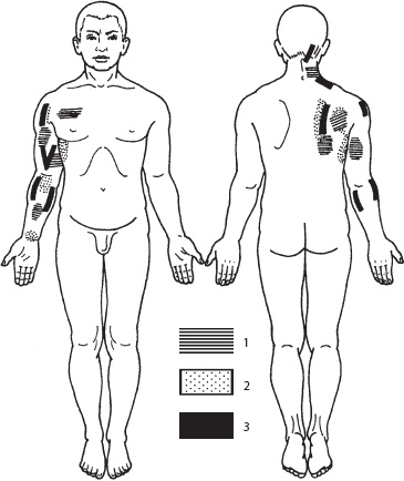 Иллюстрация к книге — Массаж. Уроки великого мастера [_124.jpg]