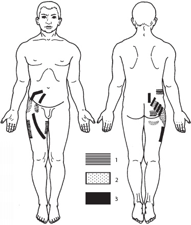 Иллюстрация к книге — Массаж. Уроки великого мастера [_125.jpg]