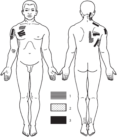 Иллюстрация к книге — Большой справочник по массажу [_128.jpg]