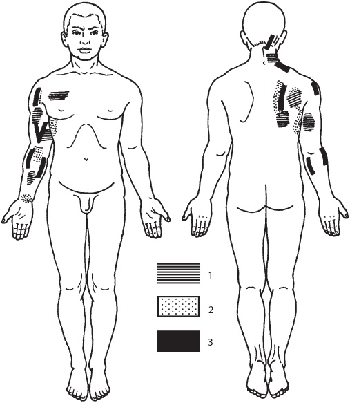 Иллюстрация к книге — Большой справочник по массажу [_129.jpg]