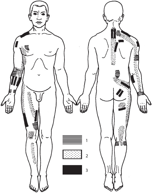 Иллюстрация к книге — Большой справочник по массажу [_143.jpg]