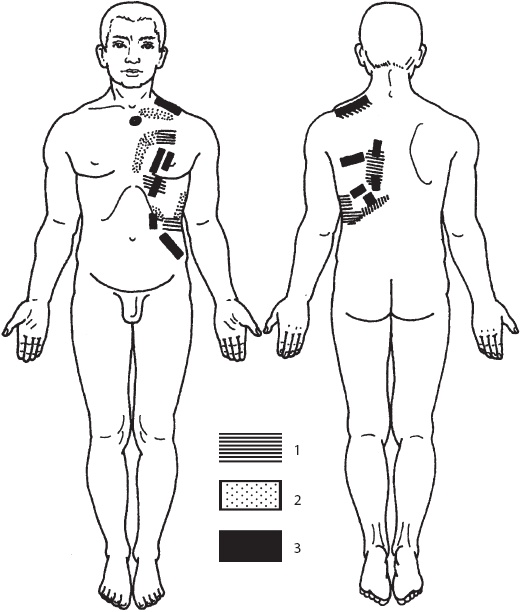 Иллюстрация к книге — Большой справочник по массажу [_144.jpg]