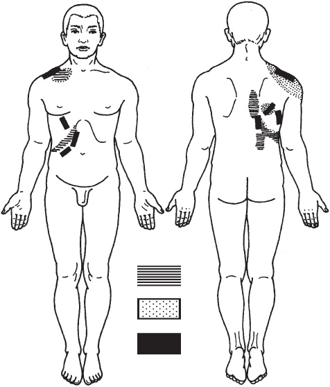 Иллюстрация к книге — Большой справочник по массажу [_155.jpg]