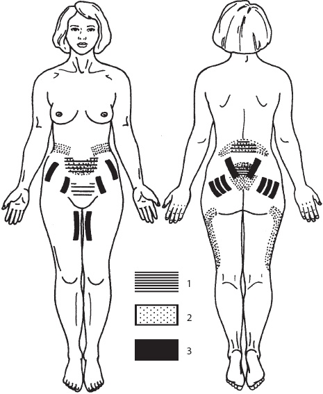 Иллюстрация к книге — Большой справочник по массажу [_157.jpg]