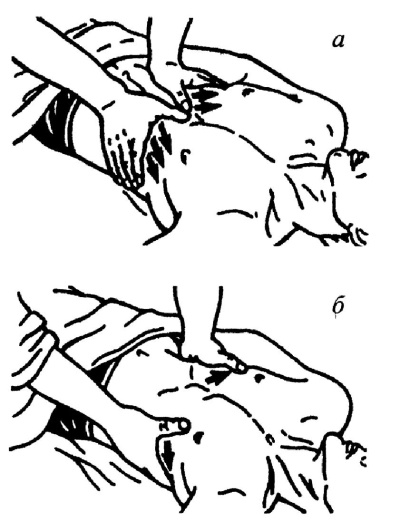 Иллюстрация к книге — Все про массаж [i_133.jpg]