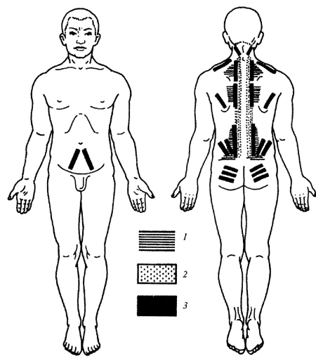 Иллюстрация к книге — Все про массаж [i_141.jpg]