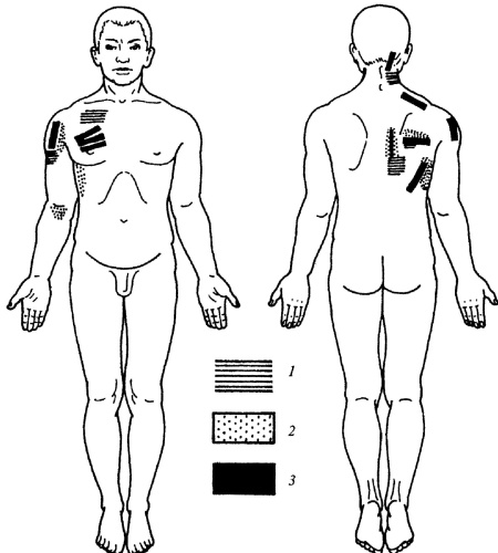 Иллюстрация к книге — Все про массаж [i_142.jpg]