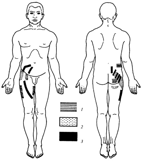 Иллюстрация к книге — Все про массаж [i_144.jpg]