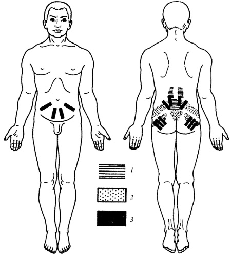 Иллюстрация к книге — Все про массаж [i_158.jpg]