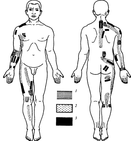 Иллюстрация к книге — Все про массаж [i_160.jpg]