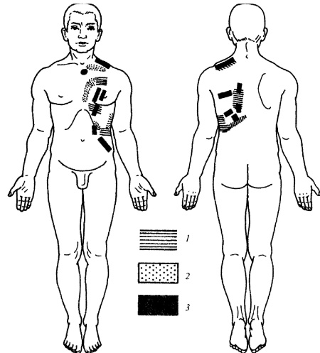 Иллюстрация к книге — Все про массаж [i_161.jpg]