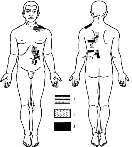 Иллюстрация к книге — Все про массаж [i_170.jpg]