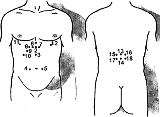 Иллюстрация к книге — Пиявки. Домашняя гирудотерапия [i_005.jpg]