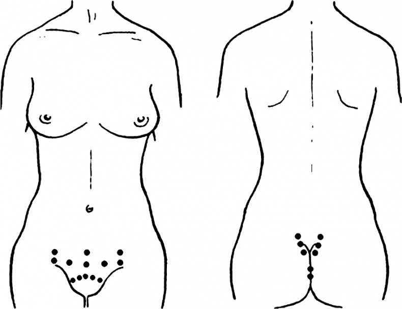 Иллюстрация к книге — Пиявки. Домашняя гирудотерапия [i_009.jpg]