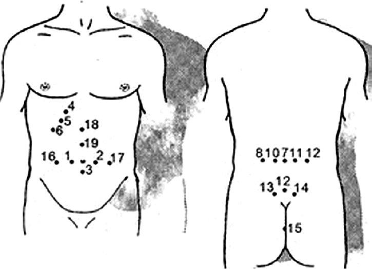 Иллюстрация к книге — Пиявки. Домашняя гирудотерапия [i_010.jpg]