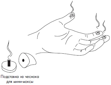 Иллюстрация к книге — Су-Джок. Самодиагностика и лечение [Autogen_eBook_id30.jpg]