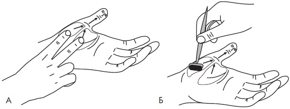 Иллюстрация к книге — Су-Джок. Самодиагностика и лечение [Autogen_eBook_id36.jpg]