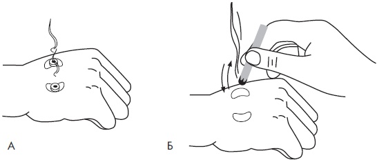 Иллюстрация к книге — Су-Джок. Самодиагностика и лечение [Autogen_eBook_id76.jpg]