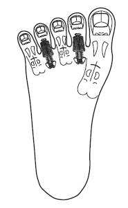 Иллюстрация к книге — Шунгит, су-джок, вода - для здоровья тех, кому за... [Autogen_eBook_id9.jpg]