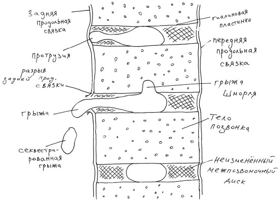 Иллюстрация к книге — Йогатерапия. Практическое руководство [i_065.jpg]