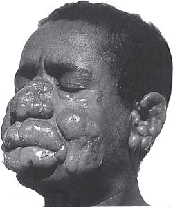 Иллюстрация к книге — Избавление от паразитов: лямблий, червей, глистов [i_011.jpg]