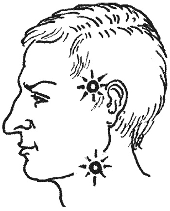 Иллюстрация к книге — 1000 советов опытного доктора. Как помочь себе и близким в экстремальных ситуациях [i_019.jpg]