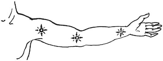 Иллюстрация к книге — 1000 советов опытного доктора. Как помочь себе и близким в экстремальных ситуациях [i_021.jpg]