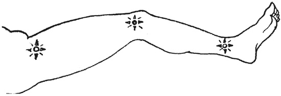 Иллюстрация к книге — 1000 советов опытного доктора. Как помочь себе и близким в экстремальных ситуациях [i_022.jpg]