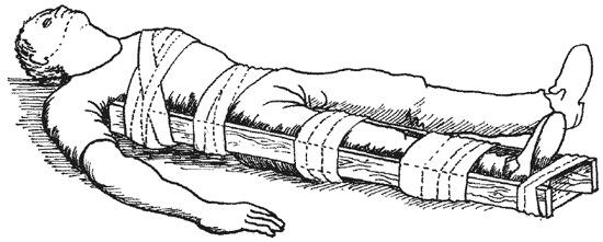 Иллюстрация к книге — 1000 советов опытного доктора. Как помочь себе и близким в экстремальных ситуациях [i_024.jpg]