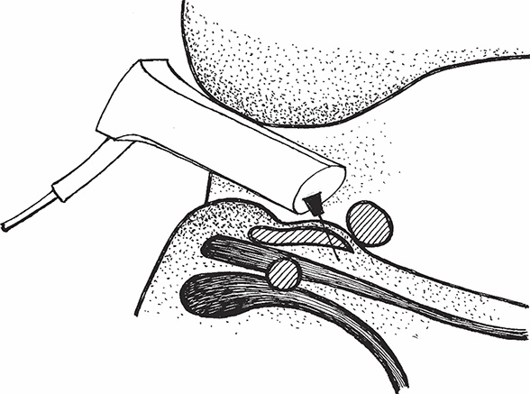 Иллюстрация к книге — Геморрой. Излечение без операции [i_014.jpg]