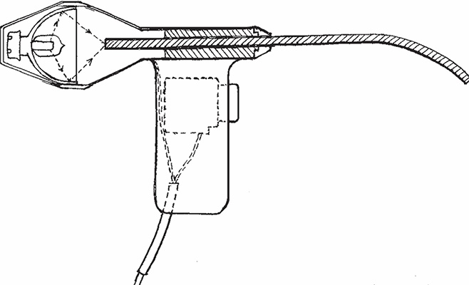 Иллюстрация к книге — Геморрой. Излечение без операции [i_015.jpg]