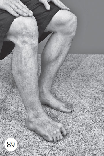 Иллюстрация к книге — Как избавиться от боли в суставах ног [i_102.jpg]