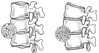 Иллюстрация к книге — Система "Живая осанка". Уникальный курс постановки осанки за 30 дней [Autogen_eBook_id102.jpg]