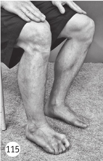 Иллюстрация к книге — Суставы без боли. Курс изометрической гимнастики [i_128.jpg]