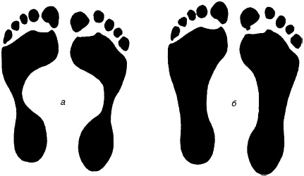 Иллюстрация к книге — Остеохондроз и плоскостопие у мужчин. Супермен и соломинка. Профилактика, диагностика, лечение [_10.jpg]