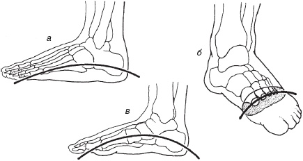 Иллюстрация к книге — Остеохондроз и плоскостопие у мужчин. Супермен и соломинка. Профилактика, диагностика, лечение [_11.jpg]